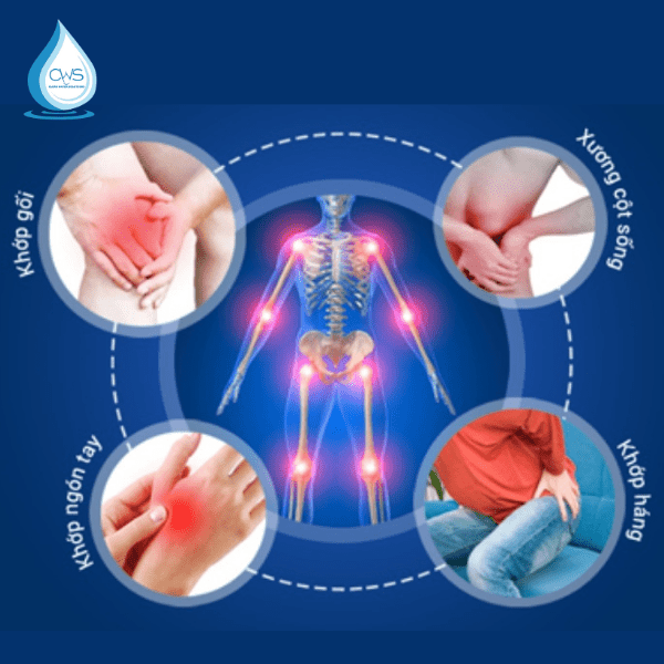 Giảm đau nhức do các bệnh lý về xương khớp